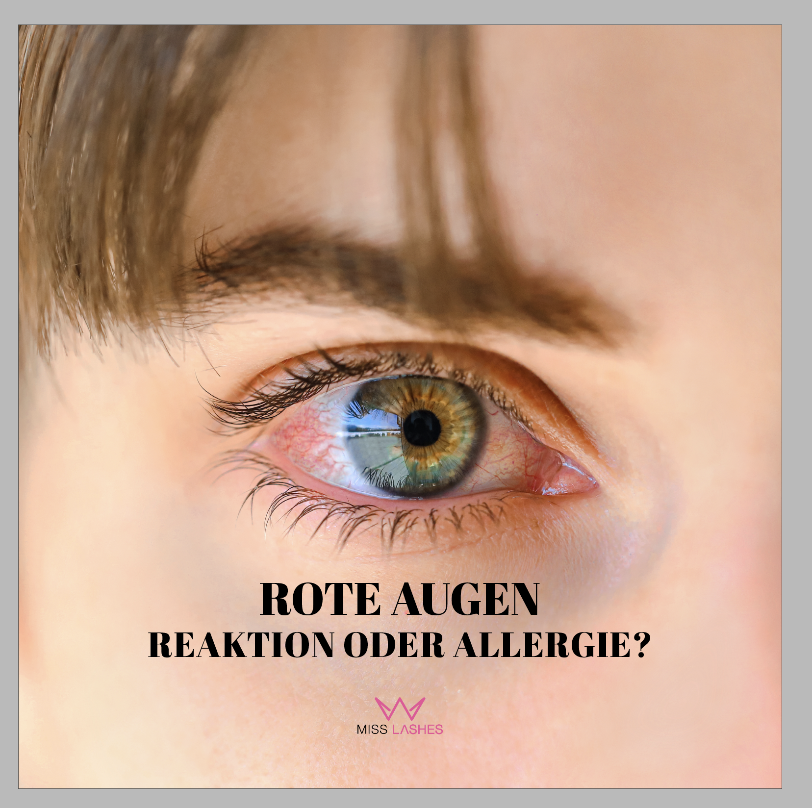Reizungen VS Allergie